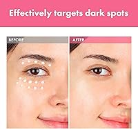 TOSOWOONG Arbutin 7% Intensive Spot Cream 20ml — image 3