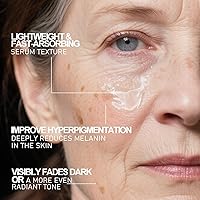 SINPIN aobenz Dark Spot Remover for Face & Body, 1.35 Fl Oz — image 6