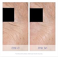 iS CLINICAL Youth Eye Complex, 2.88oz — image 4