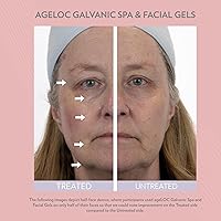 Nu Skin ageLOC GS Facial Gels 1 Pack — image 3