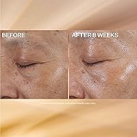 StriVectin Super-C Eye Vitamin C Eye Cream 0.51oz — image 5