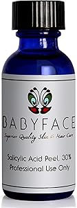 Babyface 30% Salicylic Acid Chemical Peel 1.2oz Review
