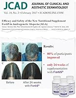 Quintessence Forti5 Hair Growth Supplement 60 Capsules — image 3