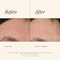 SkinMedica Retinol 0.5 Complex Serum 1 Fl Oz — image 3