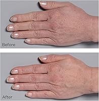 Perricone MD Cold Plasma Plus+ Hand Therapy 2 fl. oz. — image 3