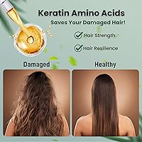 Moist Diane Anti Dandruff Shampoo and Conditioner Set, 30.4oz — image 3