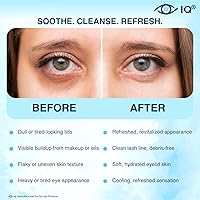 IQ HOCL PURE Eyelid Cleansing Spray 0.02% — image 4