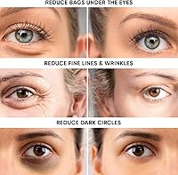 Instaderm Instant Eye Tightener 30mL — image 3