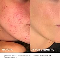 Dime Beauty Gentle Jelly Cleanser 4 oz — image 5