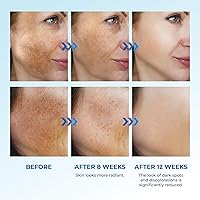 Abera Dark Spot Serum for Face 0.68 fl Oz — image 5