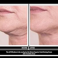 Kleem Neck Firming Cream 1.7oz — image 2