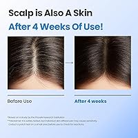 Seapuri Scalpy Hair Growth Serum for Men & Women 1.13oz — image 6