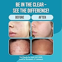 Teenology Conditioner for Teens 16 oz Sweet Mint — image 4