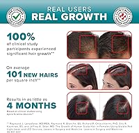 iGrow Laser Hair Growth System — image 6