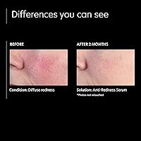 PCA SKIN Anti Redness Remover Face Serum 1 fl oz — image 4