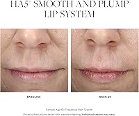 SkinMedica HA5 Smooth & Plump Lip System 0.05 Oz — image 3