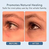 twenty/twenty Easy On The Eyes Hypochlorous Acid Spray 60ml — image 4