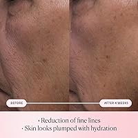 ELEMIS Pro-Collagen Rose Micro Serum 4.48oz — image 2