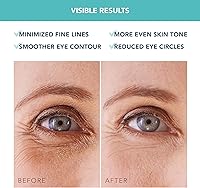 FOREO IRIS Hydrating Hydrogel Eye Mask 60 Patches — image 6