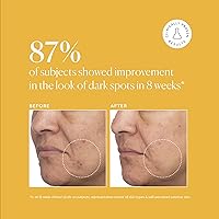 Naturium Tranexamic Topical Acid 5% Jumbo, 2 oz — image 5