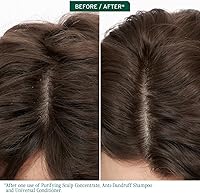 Biolage Scalp Sync Purifying Concentrate 6.8oz — image 3