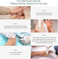 Blizzard Podiatry Tool Kit 5-Piece Set — image 3