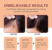 Lebanta Raw Batana Oil for Hair Growth 4oz — image 3