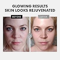 Eclat Skincare Face Serum Set – Vitamin C, Retinol, Hyaluronic Acid — image 3