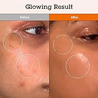 BLITHE Niacinamide 5% + Tranexamic Acid 3% Serum, 1oz — image 2