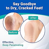 Dermal Therapy Heel Care Cream 300g — image 6