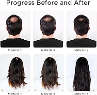 Growth Essence Minoxidil & Biotin Shampoo 3.53oz — image 4