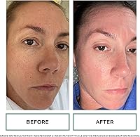 Replenix Brightening Eye Cream 0.5oz — image 6