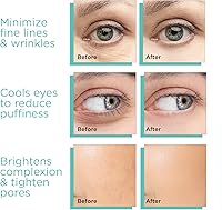 MonétBeauty Ice Globes for Face - Pink — image 5