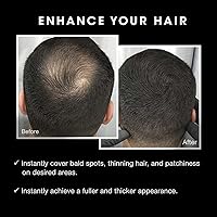 Pacinos Hair Fiber Kit - Dark Brown — image 8