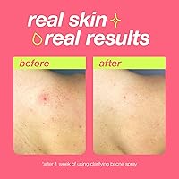 Dermalogica Clear Start Clarifying Bacne Spray, 6 fl oz — image 4