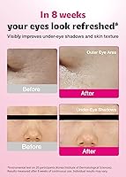 ISOI Blemish Care Under Eye Patch (90 pcs) — image 3