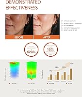 Fusid Serum 1.4fl oz — image 4