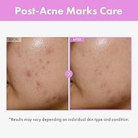 TOSOWOONG 9 Peptide Skin Booster Serum 150mL — image 3