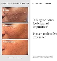 Murad Acne Control Clarifying Cleanser 6.75oz — image 4