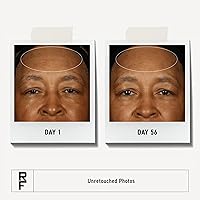 Rodan + Fields Redefine Regimen Skincare Kit — image 2