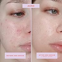 Tower 28 SOS Intensive Rescue Serum 2 FL Oz — image 2