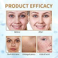 Rmoce 7% Glycolic Acid Exfoliating Toner 4.66oz — image 7