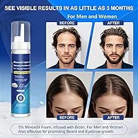AOOLCF 5% Minoxidil Foam, 12.66oz — image 4