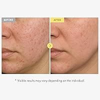 TOSOWOONG Honey Glow 65% Propolis Serum, 33mL — image 3