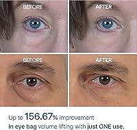 Dr.Melaxin Eyephalt Eyebag Cream 10mL — image 3