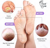 Foot Cure Lavender Foot Soak & Callus Remover Gel Kit — image 3