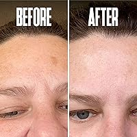 Beautiste Dark Spot Corrector Serum — image 5