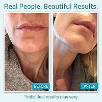 YEOUTH Day Night Face Moisturizer with Hyaluronic Acid, Snail Mucin & Copper Tripeptide, 4oz — image 4