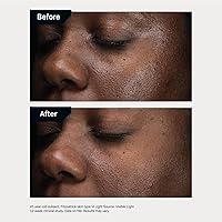 Revision Skincare D·E·J Daily Boosting Serum™ 1.7oz — image 5