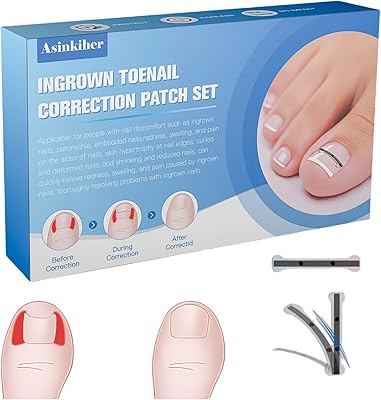 Asinkiher Titanium Alloy Ingrown Toenail Treatment Kit